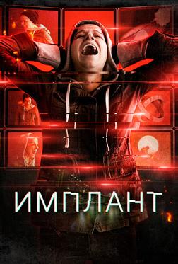 Имплант Имплант